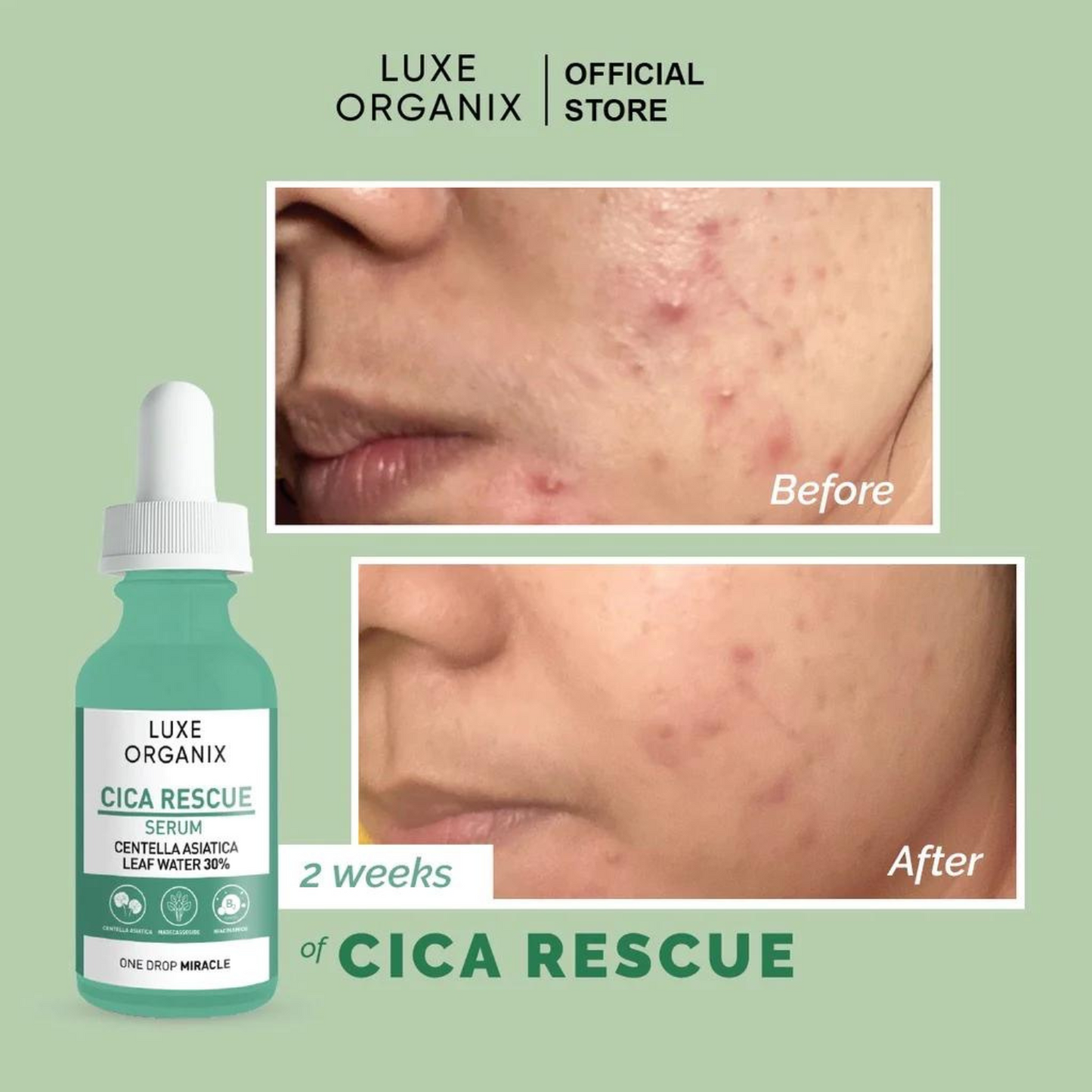 Cica Rescue Gentle Brightening Serum 30ml